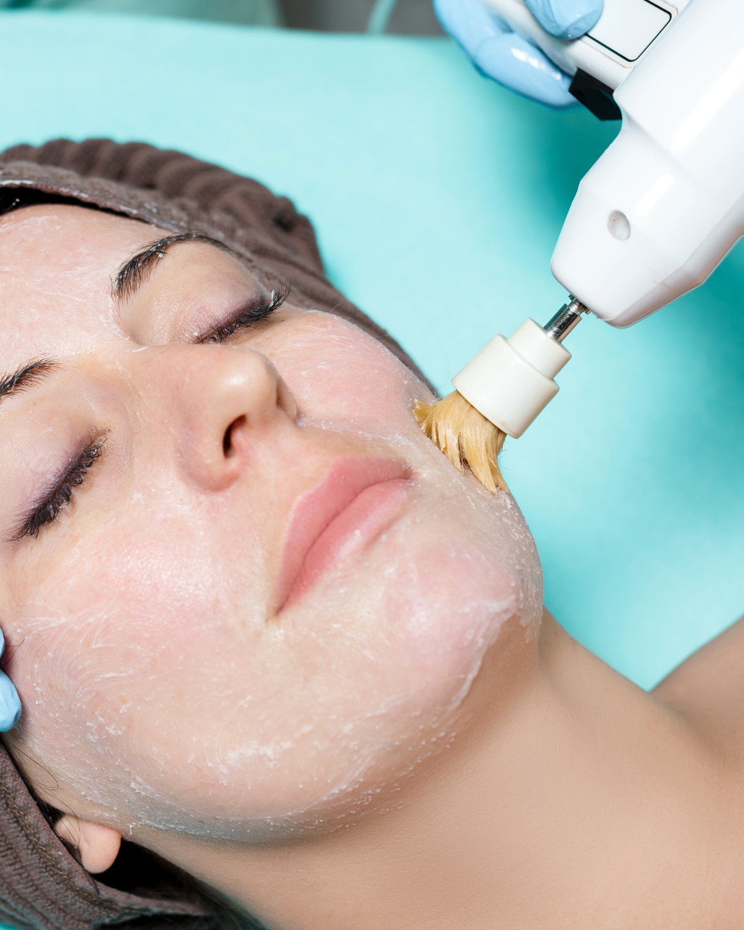 Mechanical (Physical) Peel